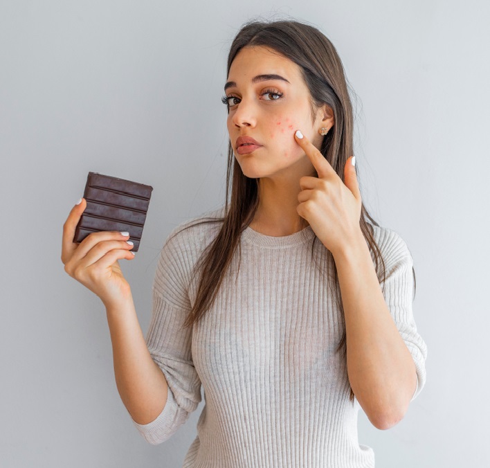 mituri si adevaruri despre acnee