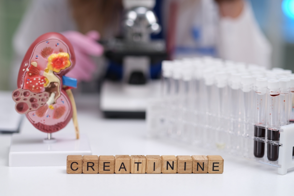 creatinina