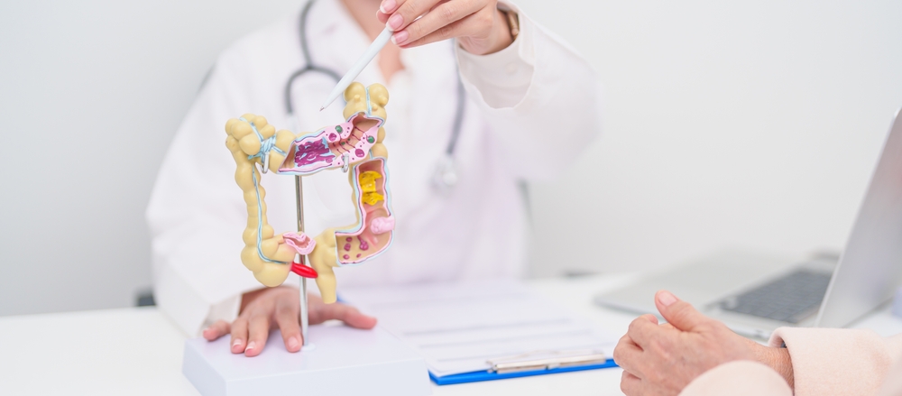 Alimente pentru profilaxia cancerului de colon