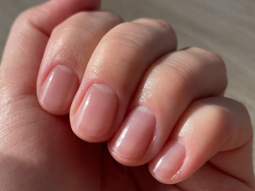 tratamente naturiste unghii fragile care se exfoliaza