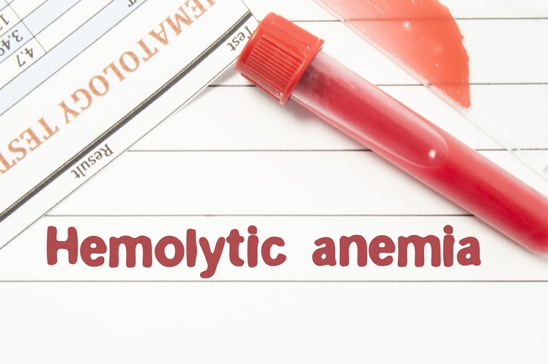 anemia hemolitica