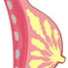 Sonoelastografia - metoda moderna si eficienta de analiza a sanului