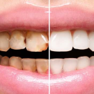 Legatura dintre obezitate si sanatatea orala