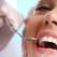 10 lucruri interesante pe care nu le stiai despre fatetele dentare