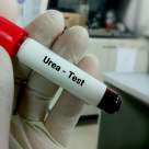 Alimente care cresc ureea serică: cauze, efecte și soluții pentru gestionarea unui nivel crescut