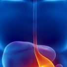 Top 4 factori de risc pentru aparitia cancerului gastric