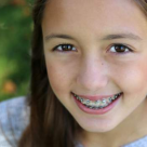 Mami, vor râde copiii de mine la școală fiindcă mi-am pus aparat dentar?