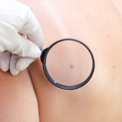 Studiu: Pompierii au un risc crescut de melanom din cauza expunerii din timpul intervențiilor 