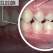 Malocluzia dentară, o afecțiune ce nu trebuie subestimată