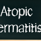 Dermatita atopica