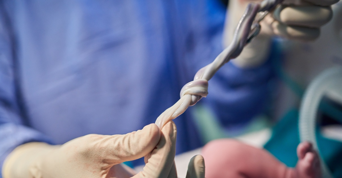 UCLA Researchers Develop Novel T-Cell Therapy from Umbilical Cord Blood to Target Solid Tumors