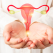 10 Mituri despre infertilitate