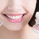 Aparatul dentar - cand este recomandat si cand nu