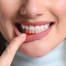 Parodontoza - cauze, simptome și cum o putem preveni 