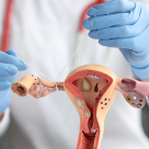 Legarea trompelor uterine: avantaje și dezavantaje