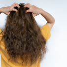 Dermatita seboreică: Cauze, simptome și tratament eficient (inclusiv șampon și cremă pentru scalp)