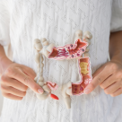 Tratamente naturiste pentru colon iritabil: ceaiuri, dietă blândă și remedii care pot calma crampele și balonarea