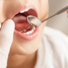 Cariile la copii - pot fi prevenite sau e natural ca ele sa apara?