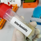 Totul despre osmolaritatea urinară: ce este și cum se măsoară