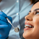 Tipuri de aparate dentare: care este cel potrivit pentru tine?