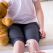 4 cele mai întâlnite afecțiuni ortopedice congenitale la copii