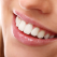 3 avantaje ale fațetelor dentare pe care este bine să le cunoști