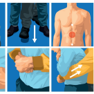 Ce atenționări fac medicii după ce o elevă de 14 ani s-a înecat cu un jeleu și a murit