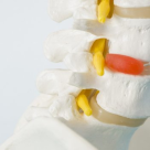 Munca la calculator si hernia de disc cervical