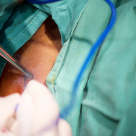 Dr. Tiberiu Tebeică, medic primar anatomopatolog: Avem mulți pacienți care vin în stadii avansate pentru că au auzit că de la biopsie faci cancer