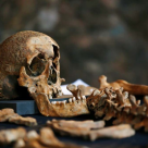 Moartea Neagră. Cea mai mare pandemie din istorie își dezvăluie secretele