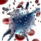 Limfomul Hodgkin sau Boala Hodgkin