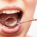 Parodontoza - cum o recunoastem si cand este cazul sa mergem la stomatolog