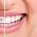 Aparatul dentar - influenta asupra simetriei faciale