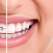 Aparatul dentar - influenta asupra simetriei faciale