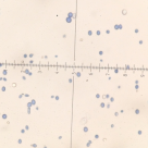 Cum tratam candida 