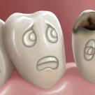 Sfaturi practice: cum am putea sa nu mai avem carii