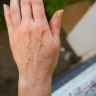Pete pigmentare pe podul palmei? Tratamente naturiste care estompează blând mâinile pătate de soare și vârstă