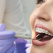Mituri despre aparatul dentar demontate de medicul ortodont