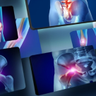 Peste 600.000 de români suferă de boli reumatismale