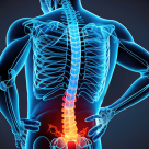 Cum să scăpăm de hernia de disc prin metode diferite?