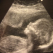 Ce trebuie sa stie o graviduta despre biometria fetala