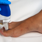 Doctor Adelina Dianu, Medic Specialist Dermatologie, AVRA Aesthetic Institute, despre tratamentul cu laser al onicomicozei 