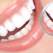 Cariile dentare - de ce apar și cum le putem preveni