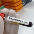 Ce înseamnă PCT crescut la analize