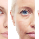 Remedii impotriva imbatranirii 