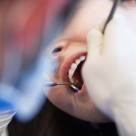 Cele mai comune motive pentru care oamenii evita vizita la stomatolog