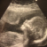 Copil nascut perfect sanatos, desi s-a dezvoltat in afara uterului