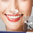 Recapata-ti albul natural al dintilor 