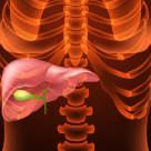 Tratamente naturiste pentru FIERE: ajută digestia și previn crizele