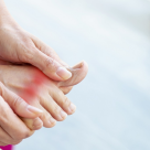 Cum să gestionezi corect și simplu guta